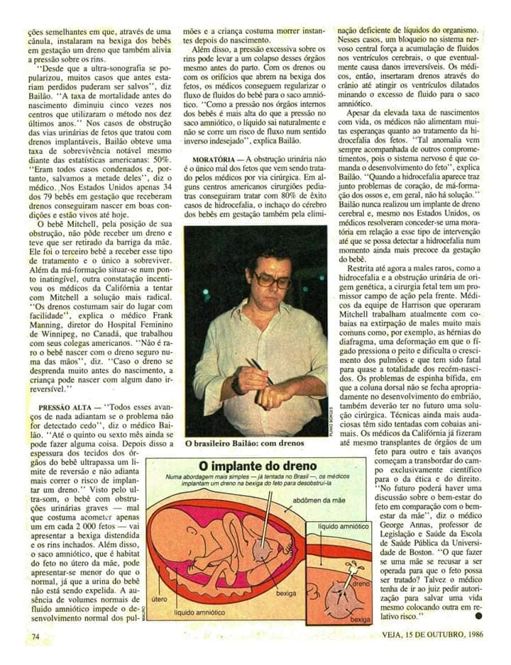 Prof. BailÃ£o em Reportagem a Revista Veja 15/10/1986