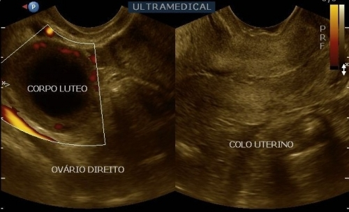 CondiÃ§Ãµes Ideais Para Ultrassom